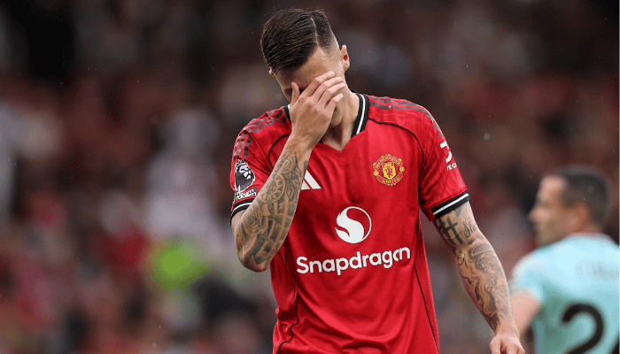 เชชโก้ เจ็บเข่า แมนเชสเตอร์ ยูไนเต็ด