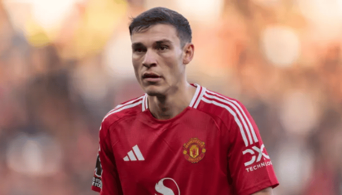 มานูเอล อูการ์เต้