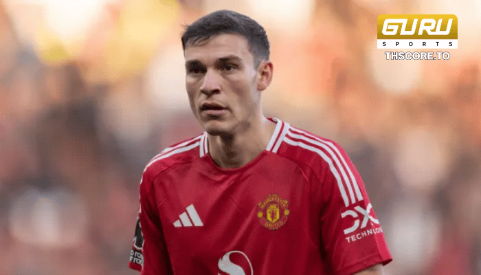 อูการ์เต้ กลายเป็นส่วนเกิน